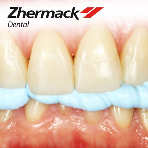 Occlufast CAD - Image 2