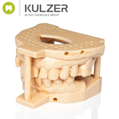 Kulzer - Dima Print Stone Beige 1Kg