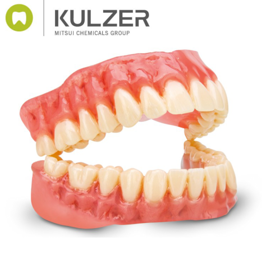 Kulzer - Dima Print Digital Denture - Image 5