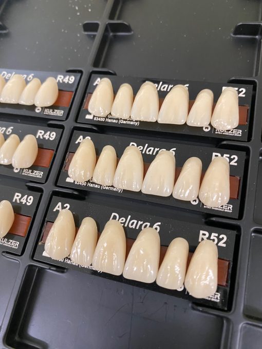 Kulzer - Delara Anteriors - Image 2