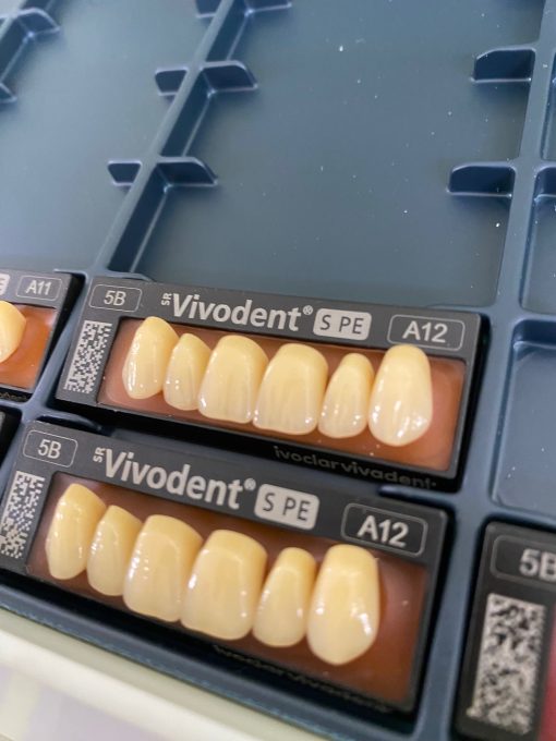 Ivoclar - SR Vivodent S DCL Anteriors - Image 2