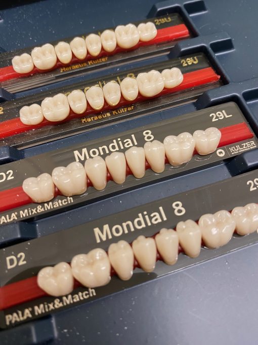 Kulzer - Pala Mondial Posteriors - Image 2