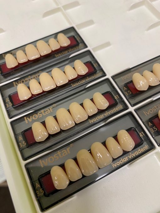 Ivoclar - Gnathostar Posteriors - Image 3