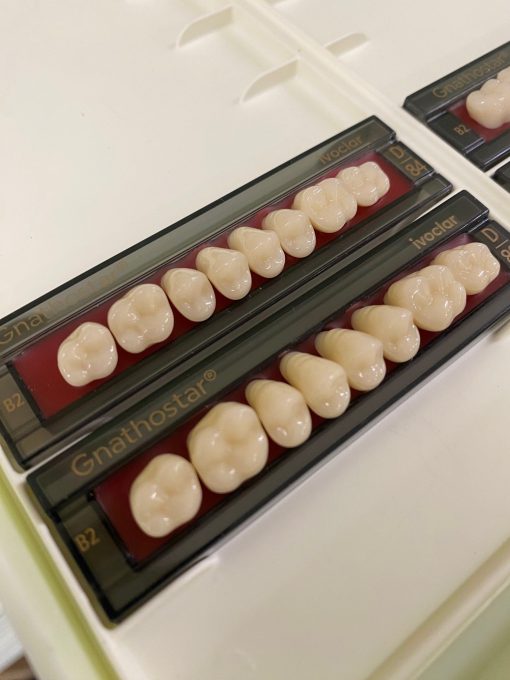 Ivoclar - Gnathostar Posteriors - Image 2