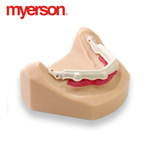 Myerson - Dentivera milling discs (made from Ultaire AKP) - Image 3