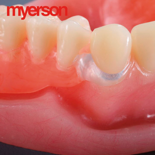 Myerson - VisiClear (Clasps and Frameworks) Cartridges - Image 3
