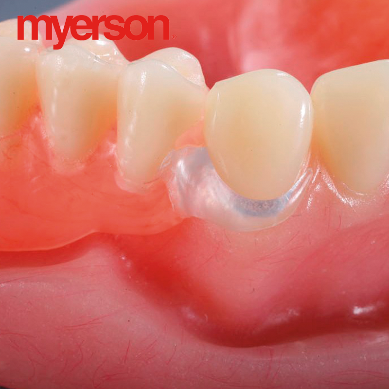 Visiclear Rpd Myerson - VisiClear CAD discs - Metrodent